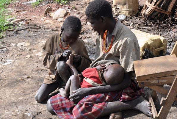 Karamoja Jigger OutBreak Contained – Nakapiripirit Health Officials