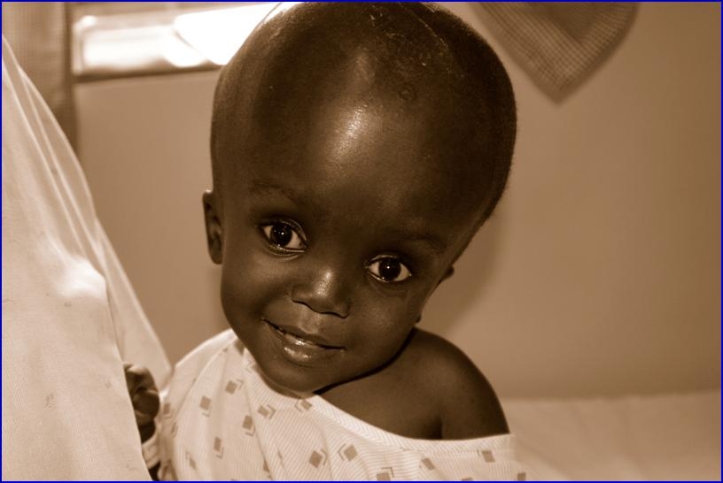 Meet Annet battling the rare hydrocephalus disease for 8 years now