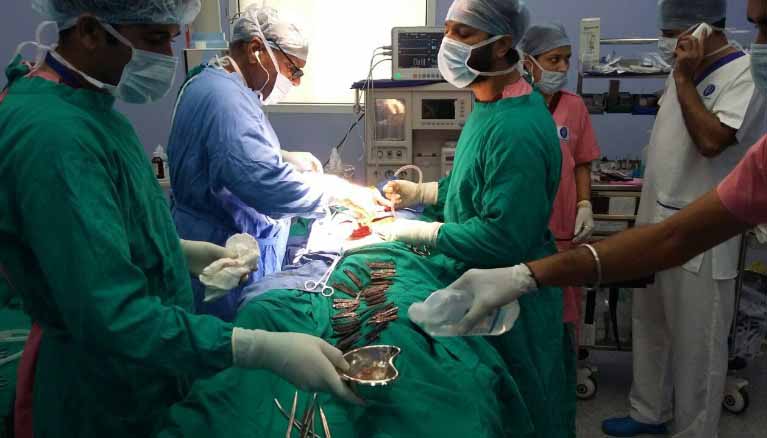 Doctors remove 40 knives from man’s stomach in India