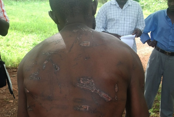 Torture survivors not happy with lengthy process of getting compensated