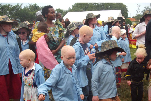 Albinos cry out for protection