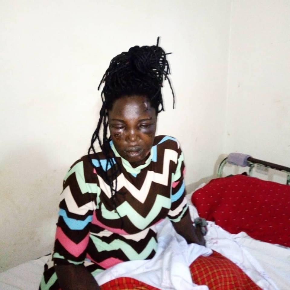 Angry Woman cuts off boyfriend’s manhood