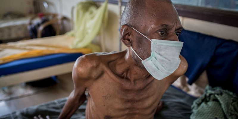 TB is curable if treated Early