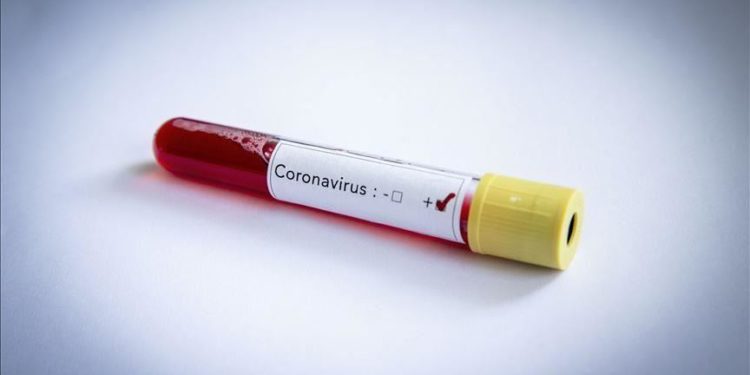 Seven inmates test Covid-19 positive in Busesa prison