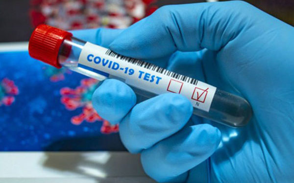 Government sets up special covid-19 re-testing centre to encounter forgeries