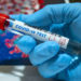Government sets up special covid-19 re-testing centre to encounter forgeries