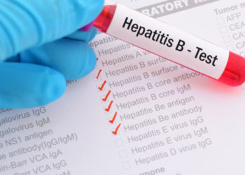 90 million people living with hepatitis in Africa-WHO