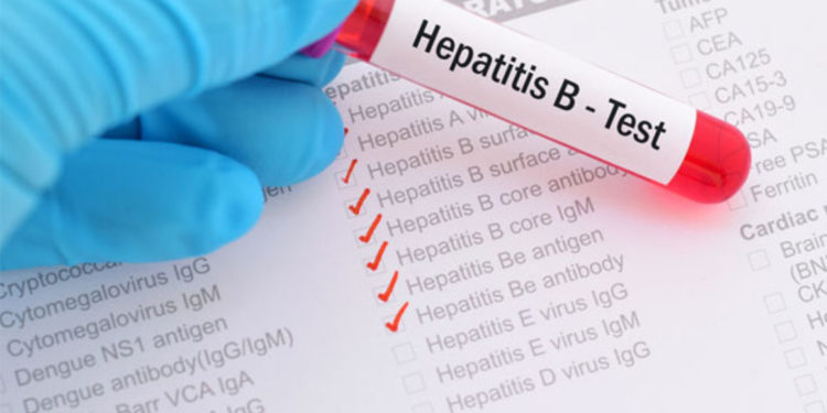 90 million people living with hepatitis in Africa-WHO