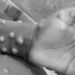 WHO okays 3 Ugandan labs, donates monkeypox test kits