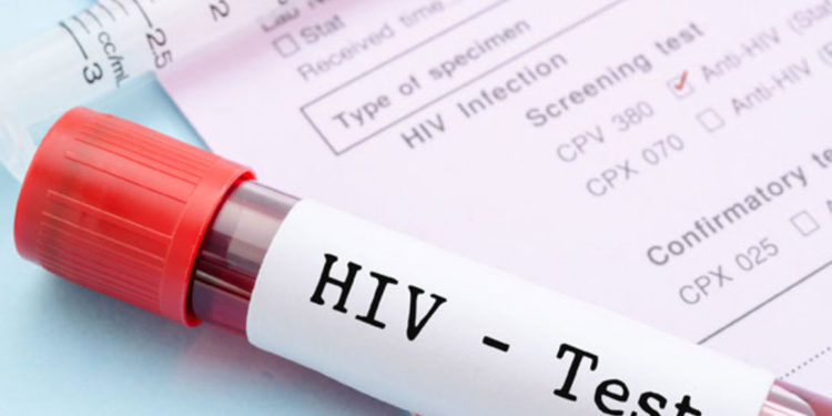 UNAIDS calls for collaboration in fight against HIV/AIDS