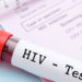 UNAIDS calls for collaboration in fight against HIV/AIDS