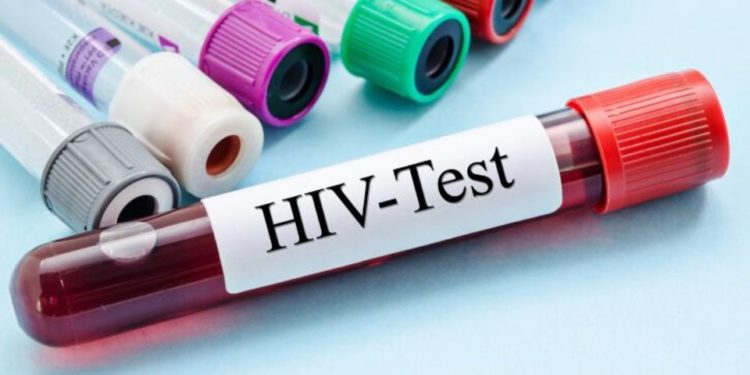 1.4 million Ugandans living with HIV – Report