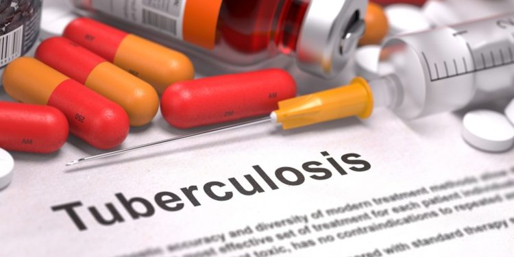 UN projects close to a million TB deaths by 2035 if prevention not implemented