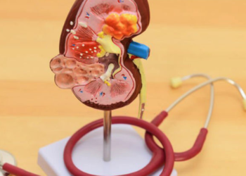 Health experts outline key drivers of kidney failure