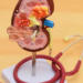 Health experts outline key drivers of kidney failure