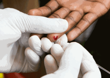 Millions of HIV-positive Ugandans under PEPFAR support