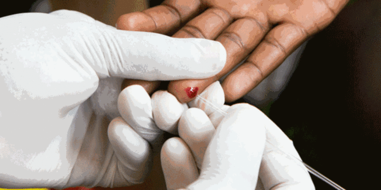Millions of HIV-positive Ugandans under PEPFAR support